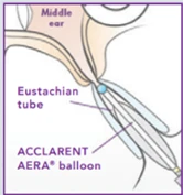 HDIW Graph 2 HDIW Graph 2