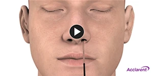 Video thumbnail of person with instrument in their nose