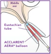 HDIW Graph 1 HDIW Graph 1