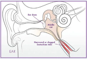 Aera Graph 1 Aera Graph 1